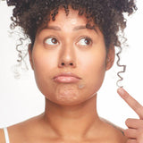 Not A Spot Acne Pimple Patch