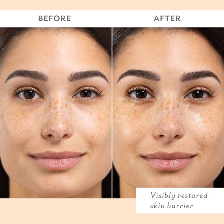 Skin Remedy Barrier Boosting Sheet Mask, 4-Pack