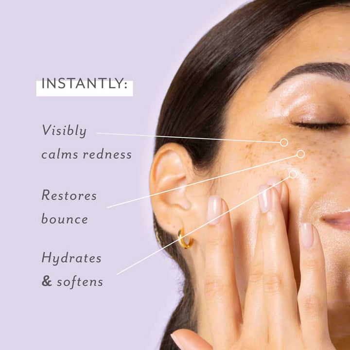Skin Remedy Barrier Boosting Sheet Mask, 4-Pack