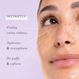 Skin Remedy Soothing Eye Gels, 5-Pack