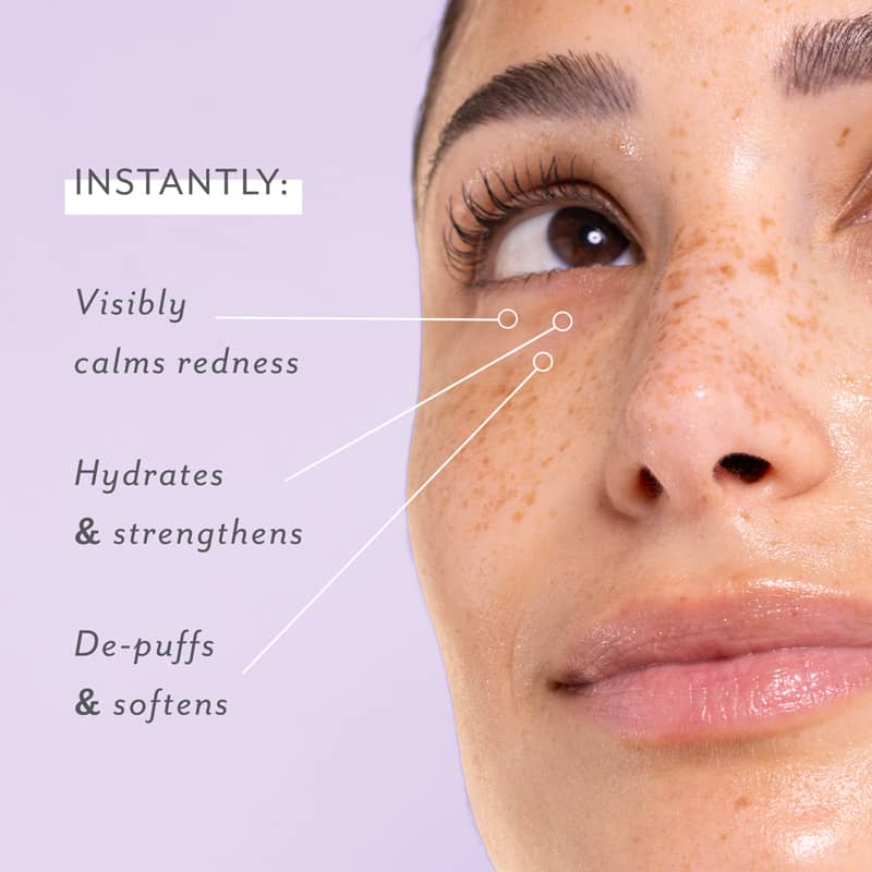 Skin Remedy Soothing Eye Gels, 5-Pack